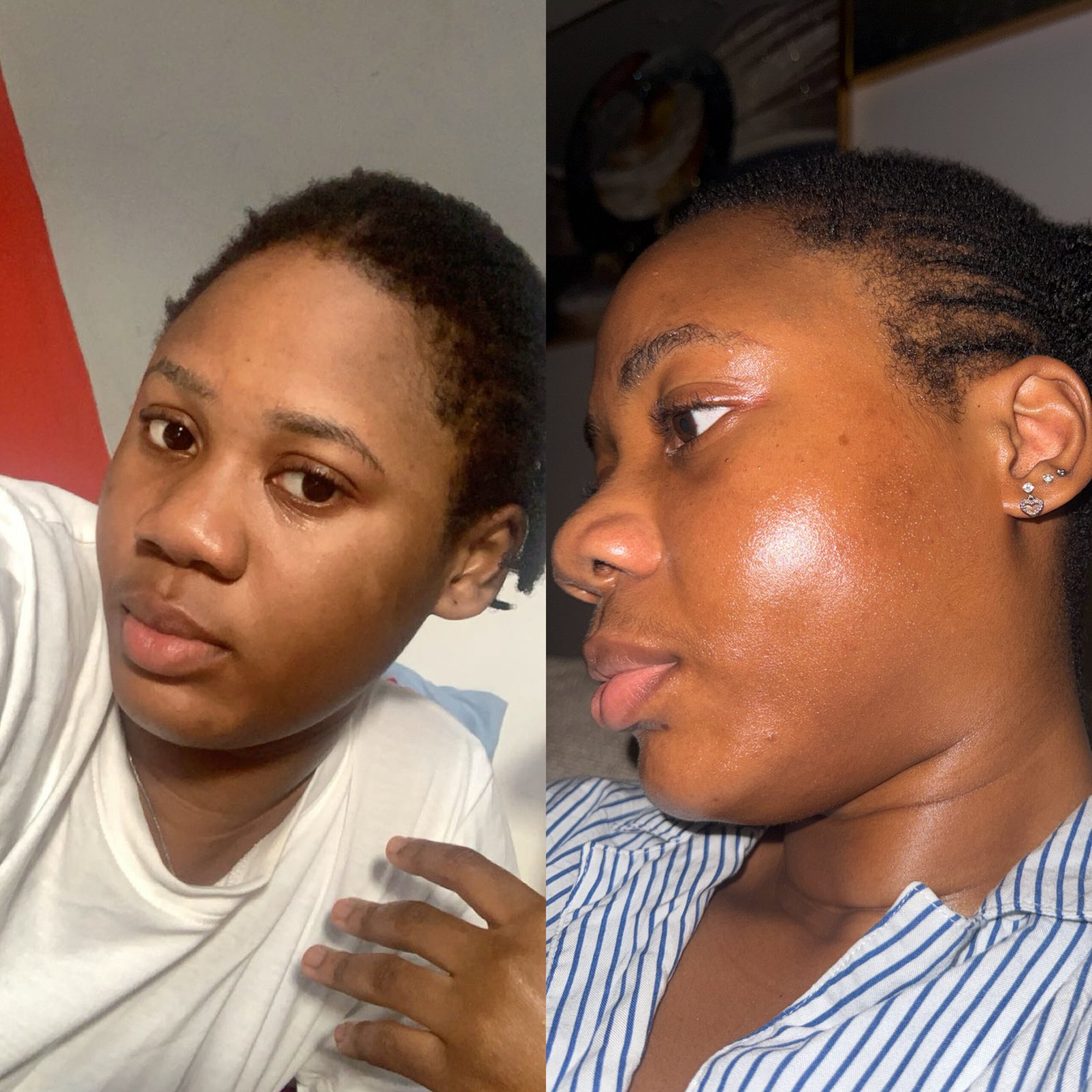 Founder skin journey before and after